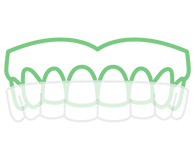 Clear Aligner (Invisalign)